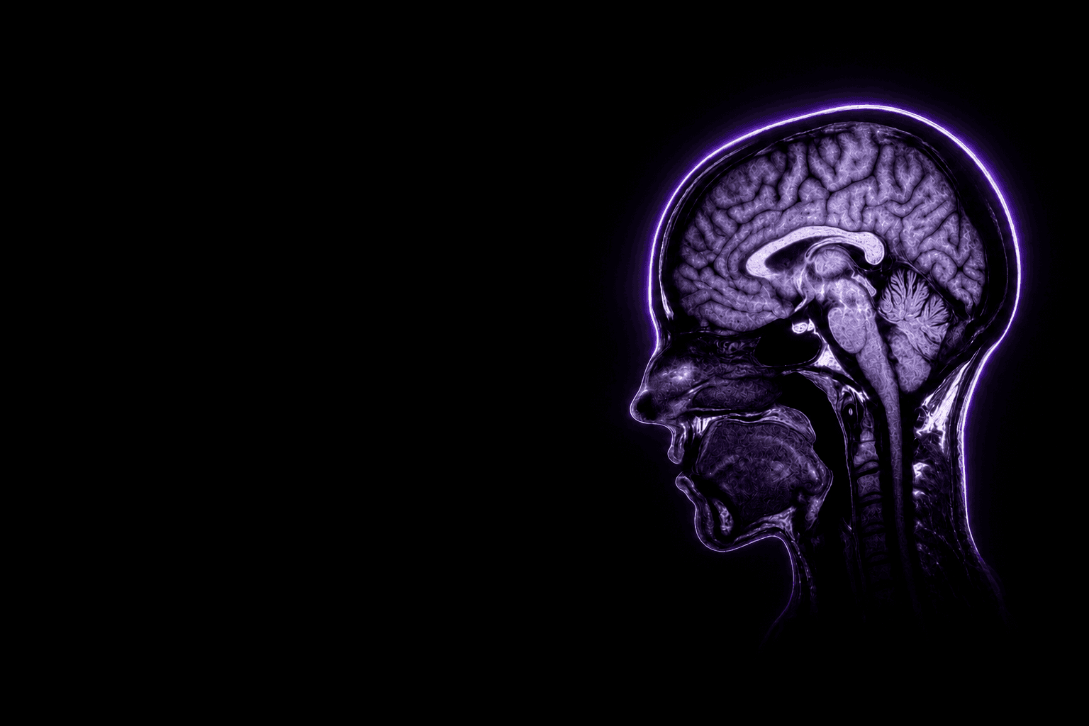 Imagen cerebral que representa Cortex AI